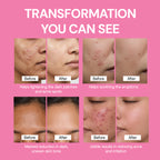 6-in-1 Brightening Facewash with Kojic Acid, Niacinamide, Glutathione-100ml