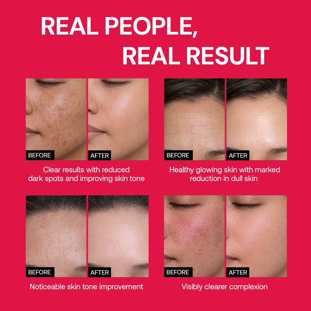 Triple Care Radiance Moisturizer for natural glow 100ml