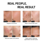 10% Vitamin C Face Serum with Niacinamide & Hyaluronic Acid 30ml